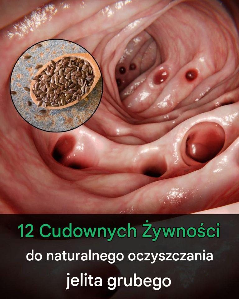12 najlepszych produktów wspierających zdrowie układu trawiennego i jelit