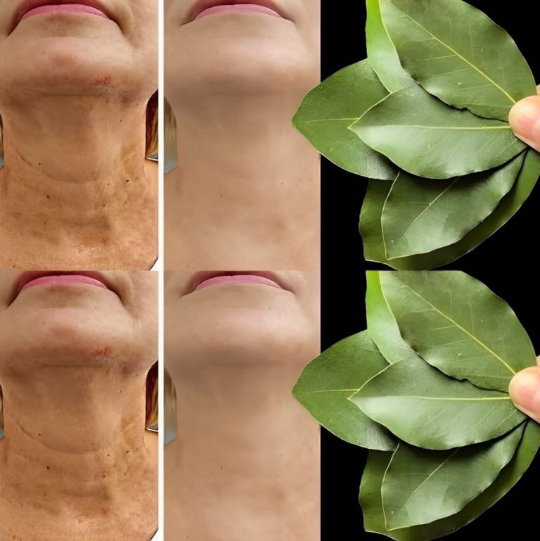 Liść laurowy jest 100 000 razy silniejszy niż botoks? | Naturalny środek na zmarszczki nawet w wieku 70 lat!