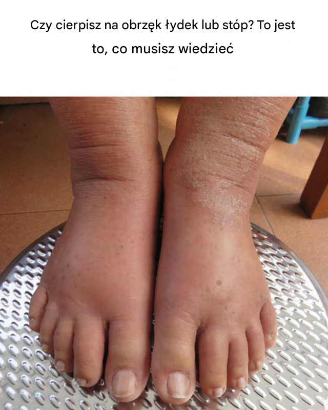 Większość ludzi o tym nie wie