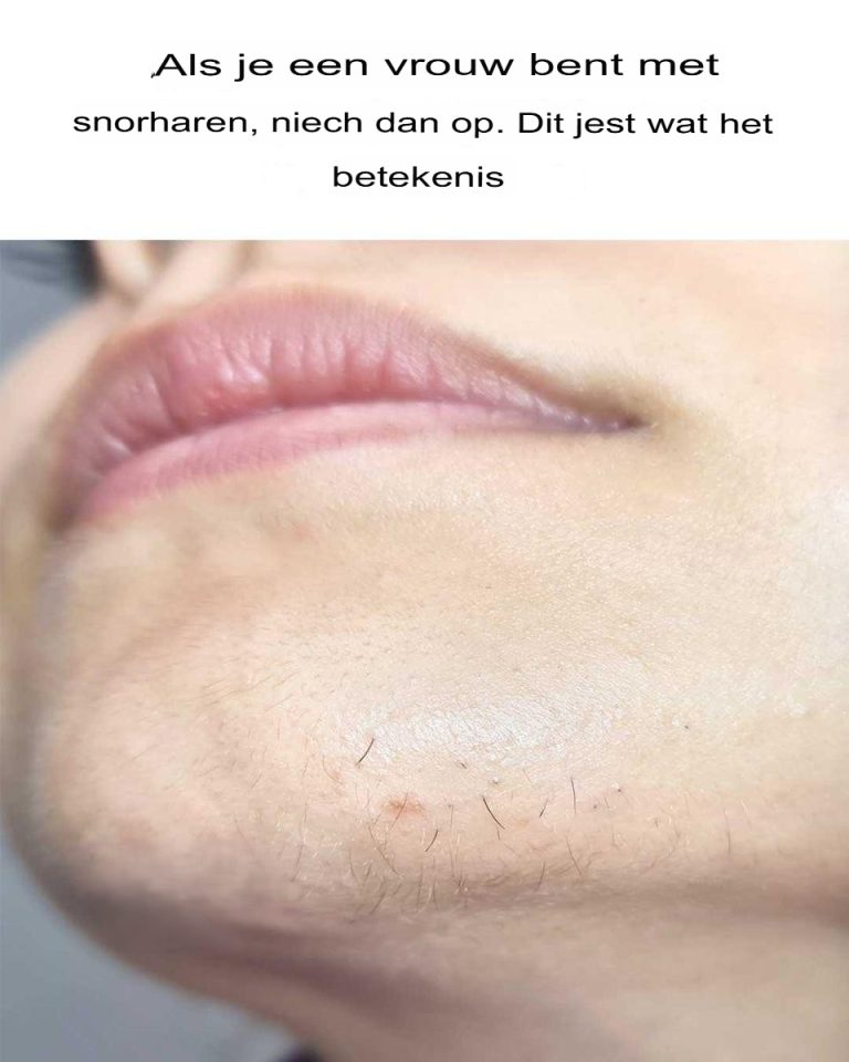 Włoski na brodzie u kobiet – przyczyny, skutki i sposoby radzenia sobie