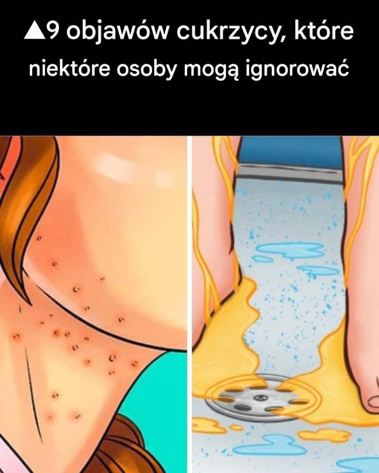 9 objawów cukrzycy, które większość ludzi ignoruje