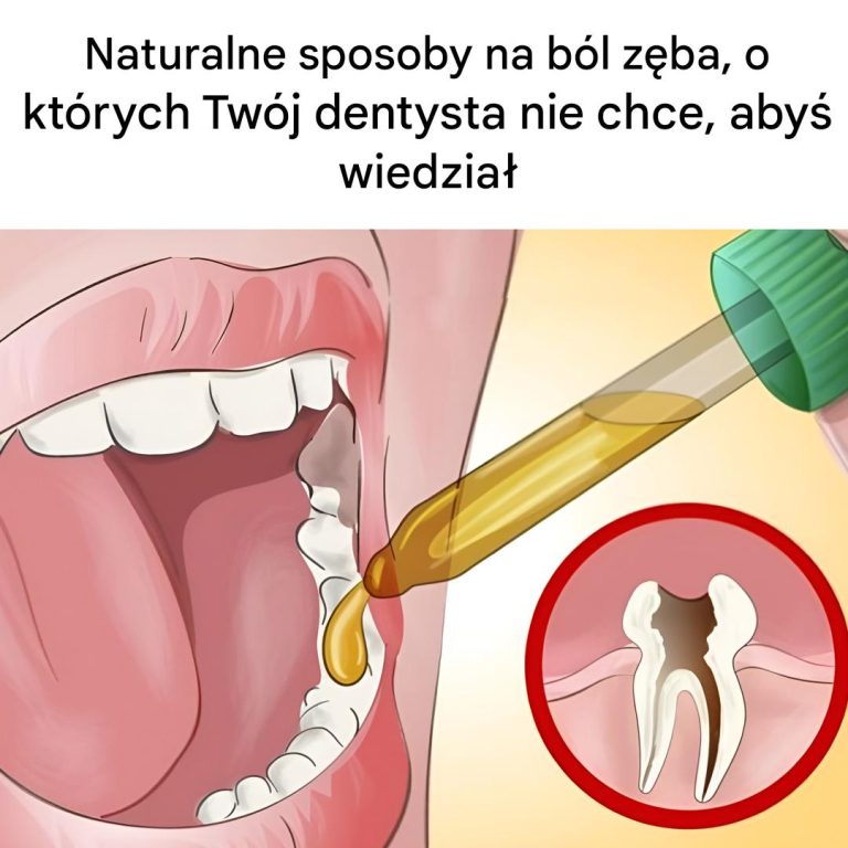Naturalne sposoby na ból zęba