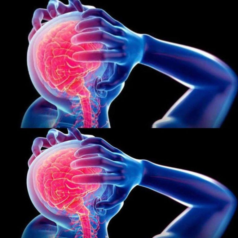 Udar: Te ostrzegawcze objawy pojawiają się na 1 miesiąc przed