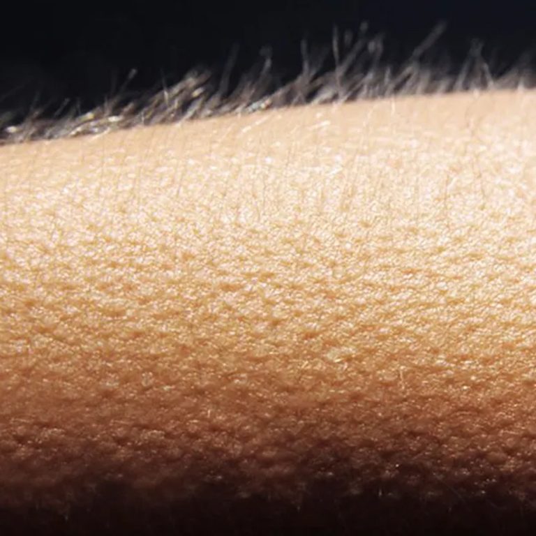 Dreszcze bez wyraźnego powodu? Dowiedz się, co Twoje ciało może Ci próbować powiedzieć