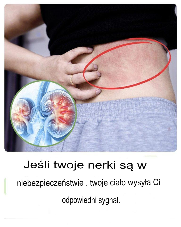 10 subtelnych oznak, że możesz mieć problemy z nerkami – naucz się je rozpoznawać, zanim będzie za późno