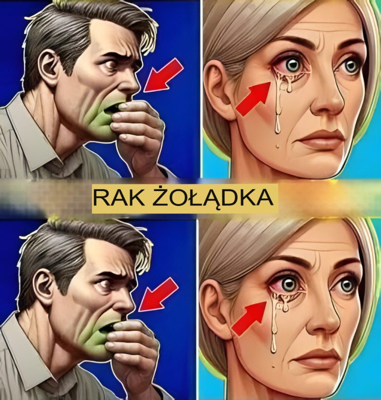 Jeśli masz raka żołądka i nie wiesz o tym, oto wyraźne objawy, które na to wskazują.