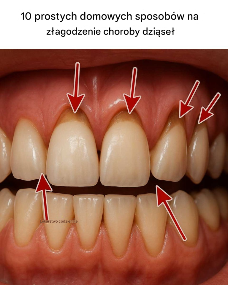 10 prostych domowych sposobów na złagodzenie choroby dziąseł