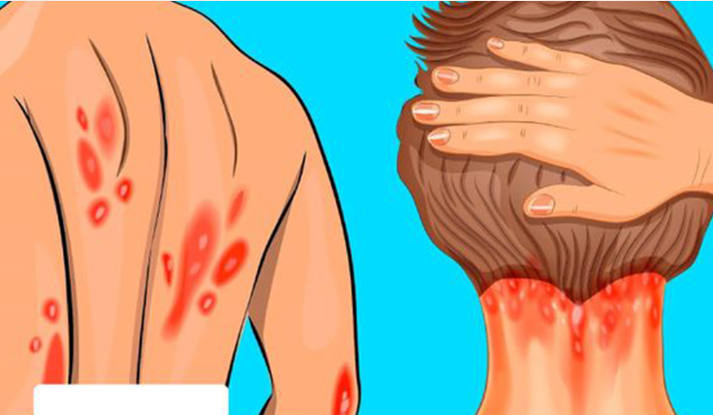 15 oczywistych oznak niedoboru witaminy D