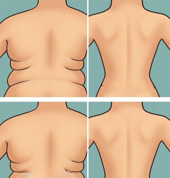 15 najlepszych sposobów na redukcję tłuszczu na bokach