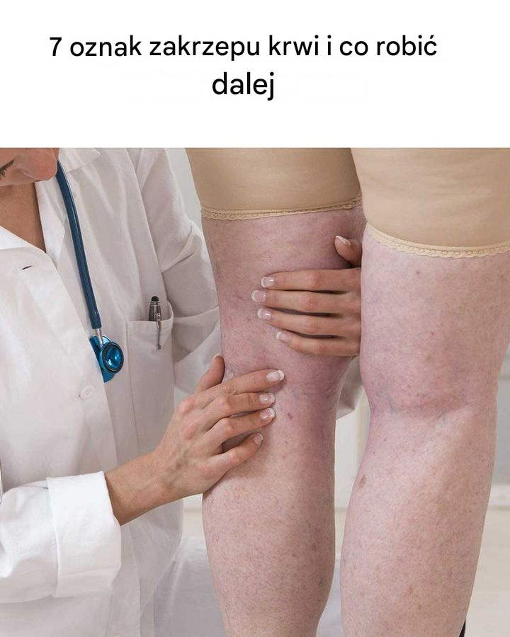 Tak przydatne! Będę na nie uważać