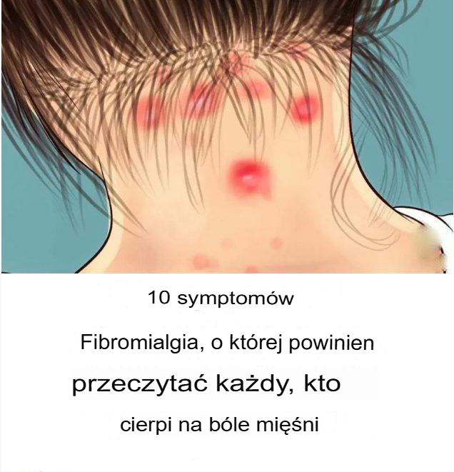 10 objawów fibromialgii, które każdy z bólem mięśni powinien przeczytać