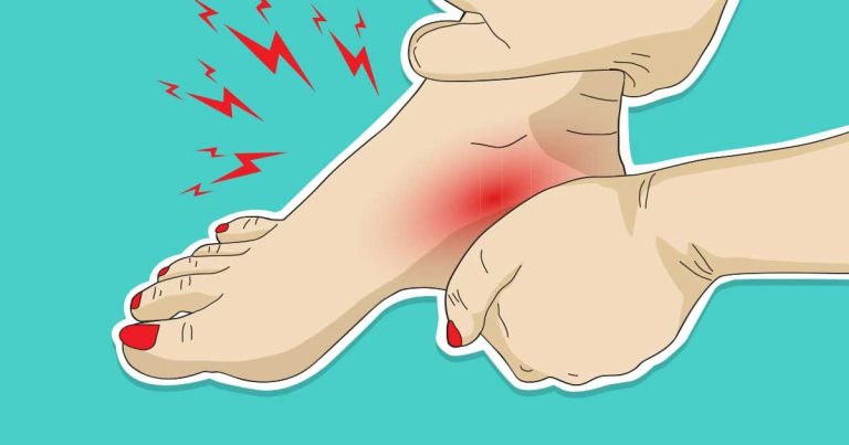 Uwolnij się od bólu pięty w sposób naturalny dzięki tym 9 pomysłom