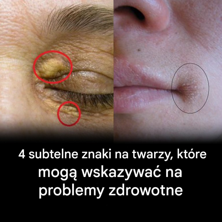 4 subtelne oznaki na twarzy, które mogą wskazywać na problemy zdrowotne