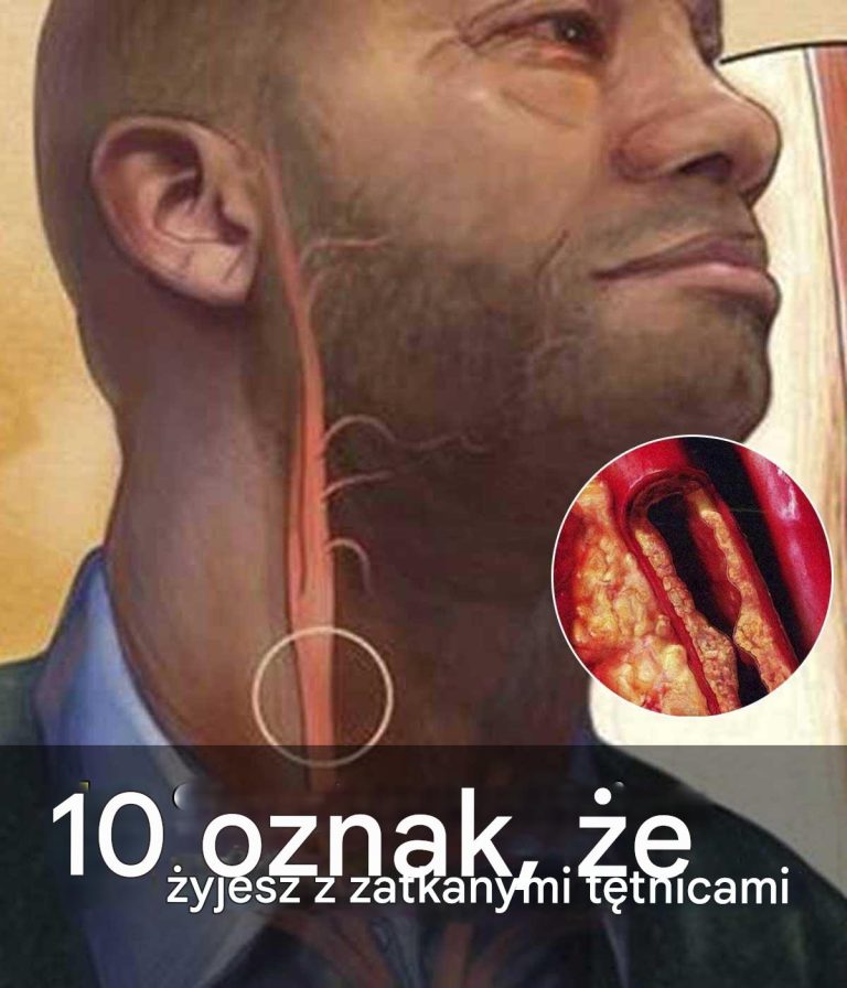 10 oznak, że żyjesz z zatkanymi tętnicami