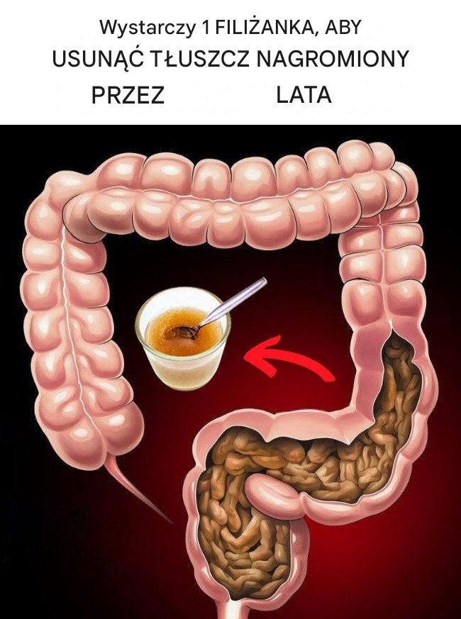 Pij ten napój każdego ranka, aby wypłukać toksyczne tłuszcze gromadzone przez lata!
