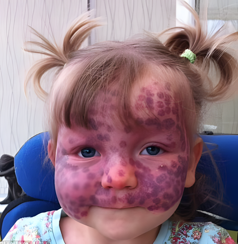 💔 „Rozdzierająca serce historia Matildy Callaghan – małej dziewczynki z plamkami, która poruszyła wszystkich”