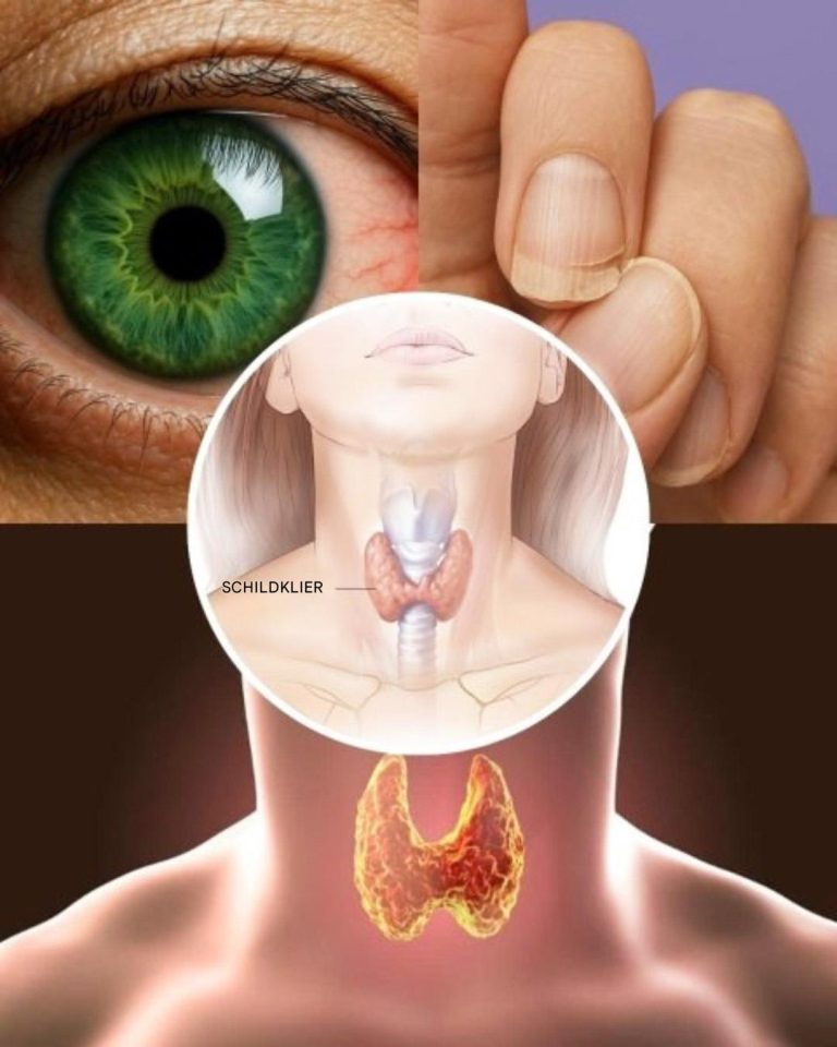 10 ukrytych oznak, że Twoja tarczyca nie działa prawidłowo