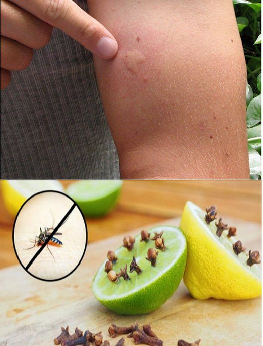 Jak pozbyć się komarów za pomocą dwóch kuchennych składników: Niezawodna pułapka na muchy: Nigdy ich więcej nie zobaczysz