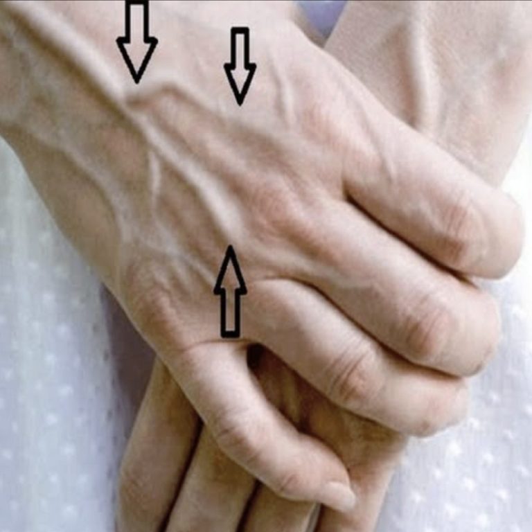 Jeśli masz widoczne żyły, oznacza to, że