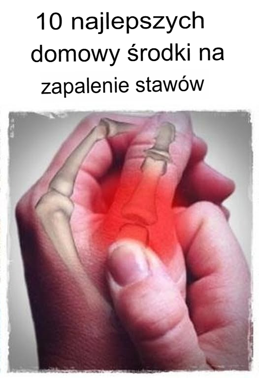 10 najlepszych domowych sposobów na zapalenie stawów