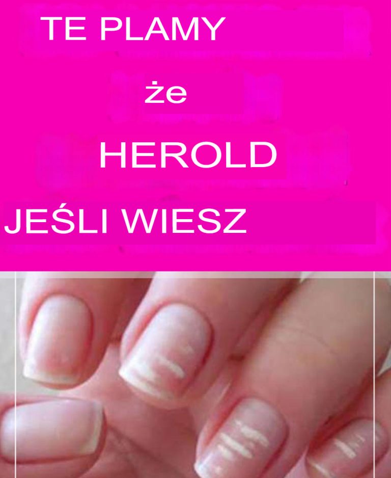 O czym świadczą te plamy?