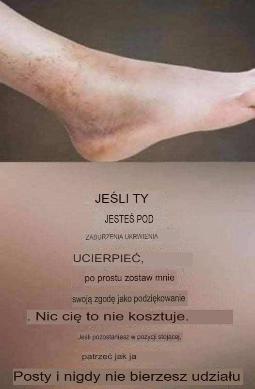 Jeżeli cierpisz na problemy z krążeniem, to jest rozwiązanie twojego problemu.
