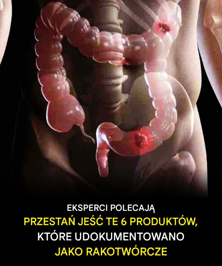 6 potencjalnie rakotwórczych produktów spożywczych, których należy unikać