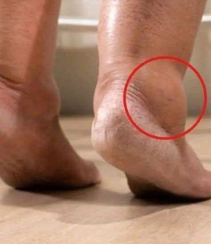 Pożegnaj się z opuchniętymi stopami dzięki tym naturalnym i skutecznym poradom, które przyniosą szybką ulgę