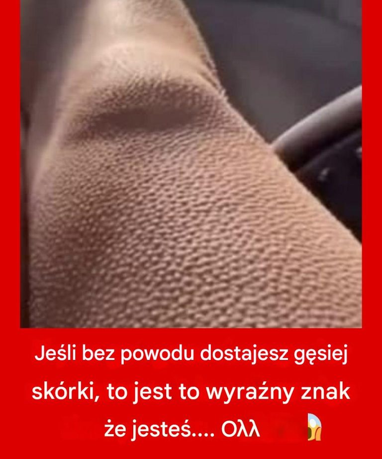 Jeśli bez powodu dostajesz gęsiej skórki, to jest to wyraźny znak, że…