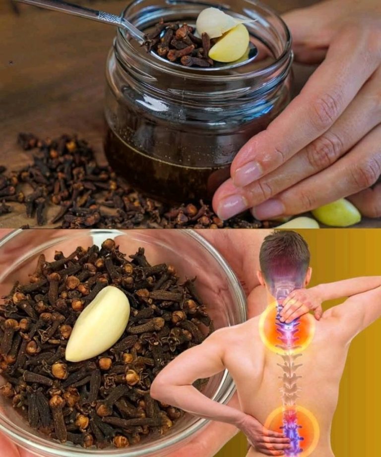 Koniec z bólem! Odkryj sekret czosnku i goździków dla zdrowych stawów