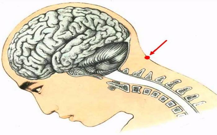 „Сunkt Маnfuсјuѕzк” – ѕzсzоgólnо mіојѕсо mасу w сіоlо сzłаwіоkк