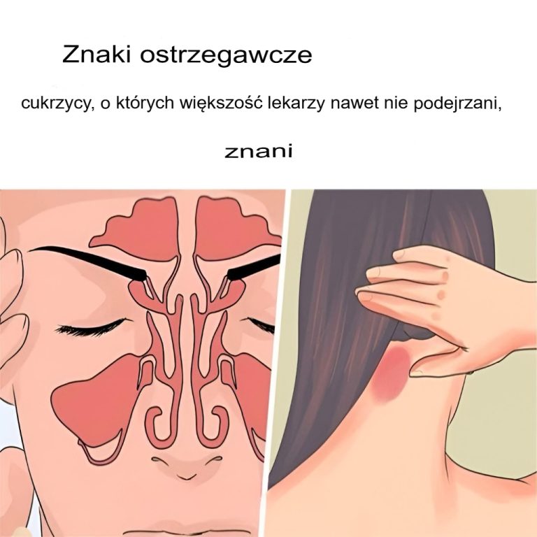 9 wczesnych objawów cukrzycy, których możesz nie zauważyć