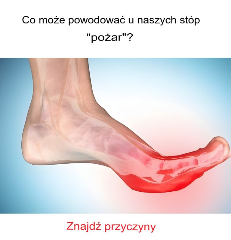 Co może powodować „palenie” stóp? Odkryj przyczyny
