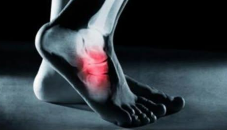 Ból w podeszwach stóp po przebudzeniu? Uważaj na ten potencjalny objaw niebezpiecznej choroby!