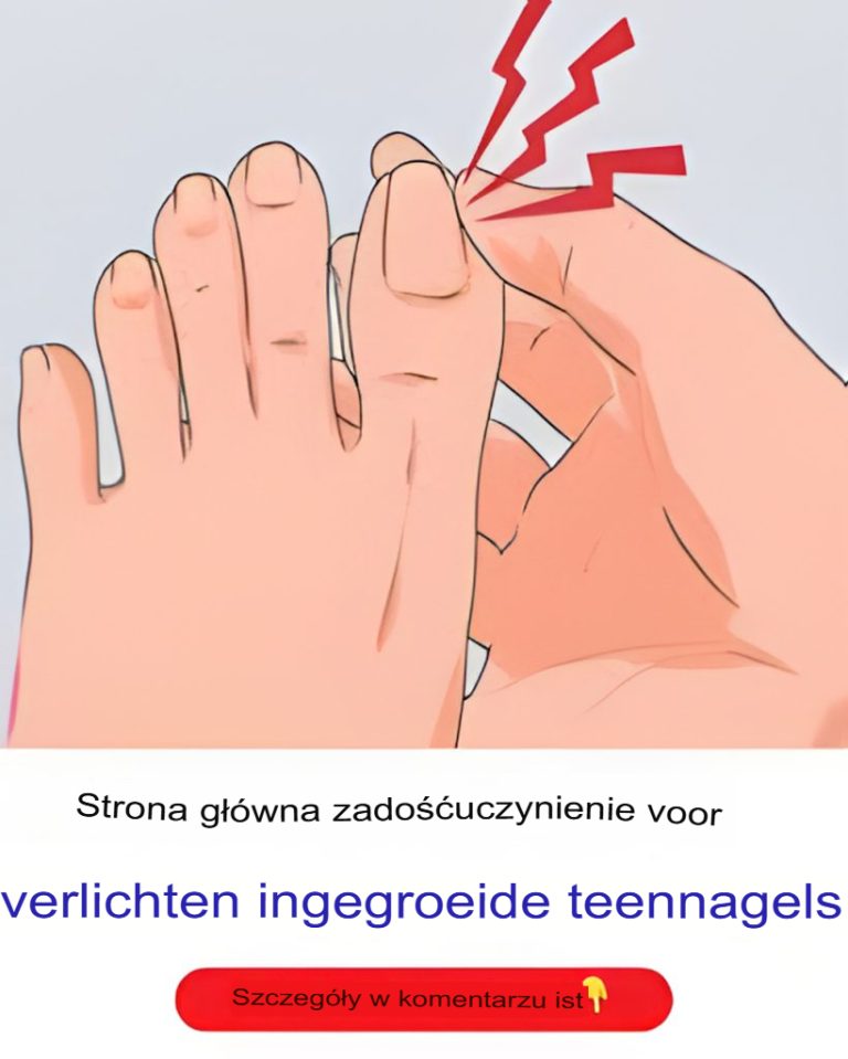 Domowe sposoby na złagodzenie wrastających paznokci