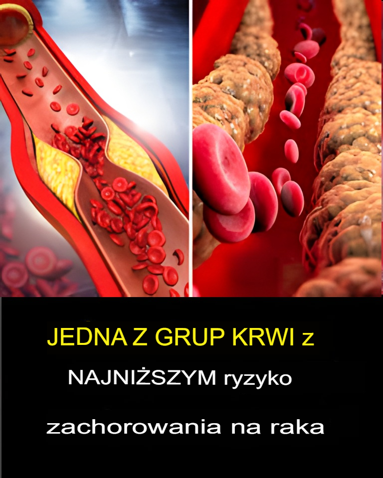 Lekarze ujawniają grupę krwi o najniższym ryzyku zachorowania na raka