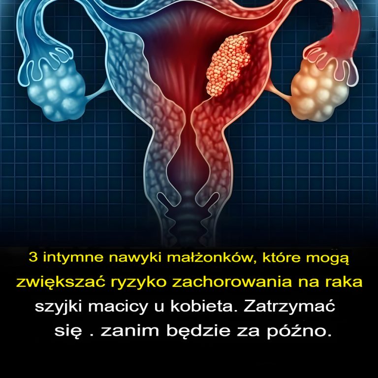 3 nawyki mężczyzn, które mogą zwiększać ryzyko zachorowania na raka szyjki macicy u ich żony