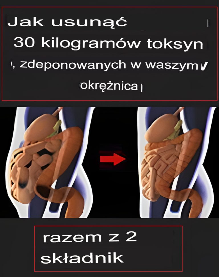 Jak usunąć 30 funtów toksyn z jelita grubego za pomocą zaledwie 2 składników