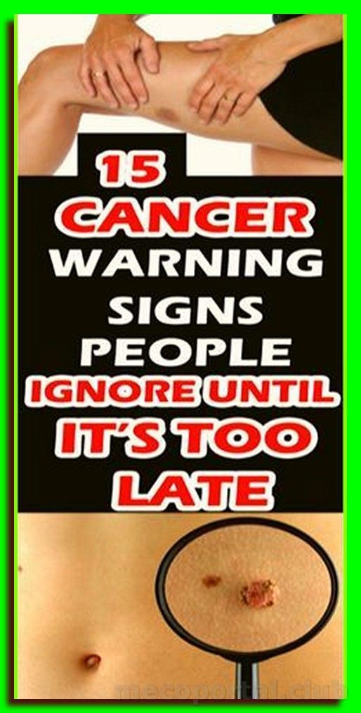 15 objawów raka, które kobiety często ignorują