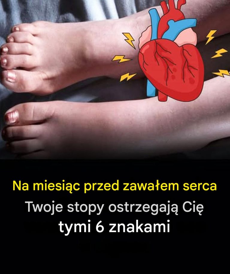 Miesiąc przed zawałem serca Twoje stopy mogą Cię ostrzec tymi 6 znakami