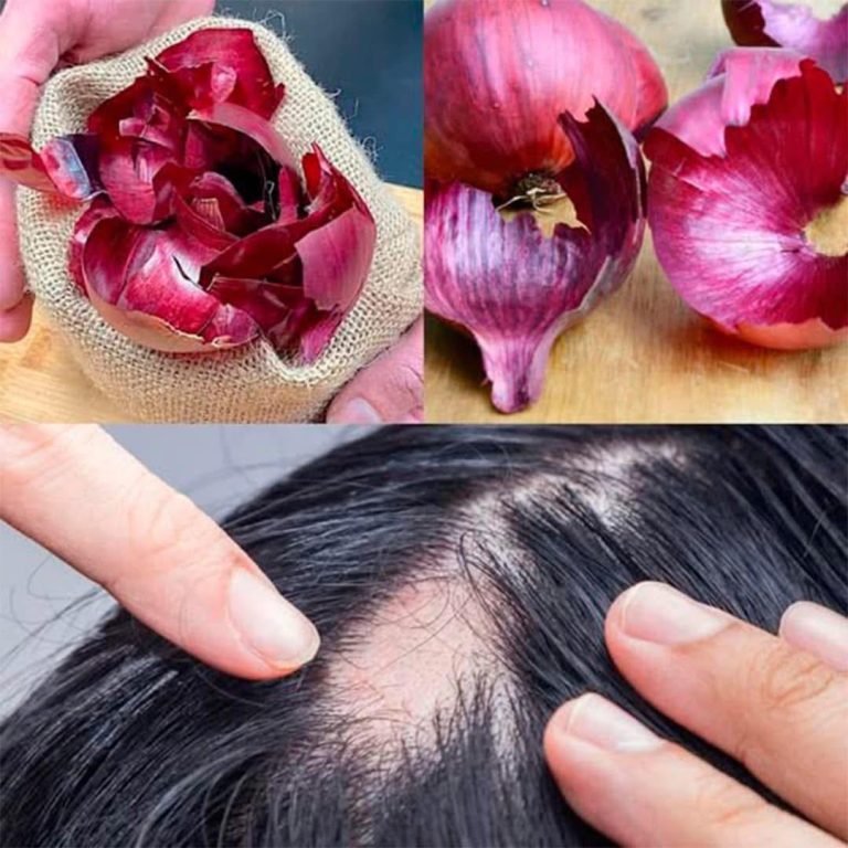 Szampon cebulowy: jego liczne zalety