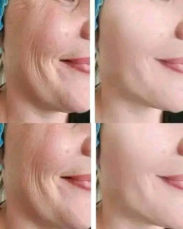 Magiczny olejek przeciwstarzeniowy. Ten olejek usunie wszystkie zmarszczki na Twojej twarzy.