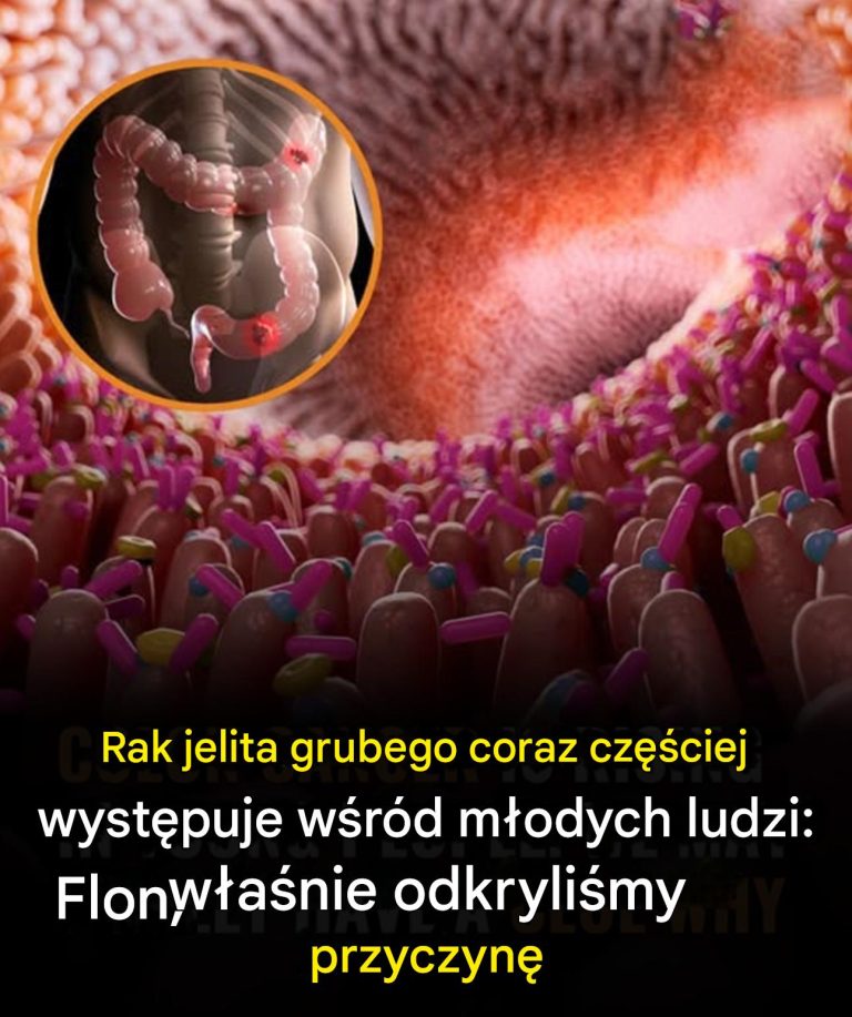 Być może w końcu poznaliśmy odpowiedź na rosnącą liczbę zachorowań na raka jelita grubego wśród młodych dorosłych