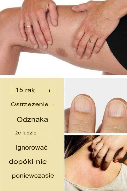 15 ostrzegawczych znaków raka, które ludzie ignorują, dopóki nie jest za późno