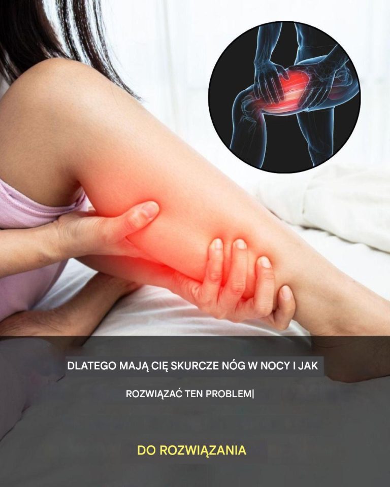 Oto dlaczego dokuczają Ci skurcze nóg w nocy i jak się ich pozbyć
