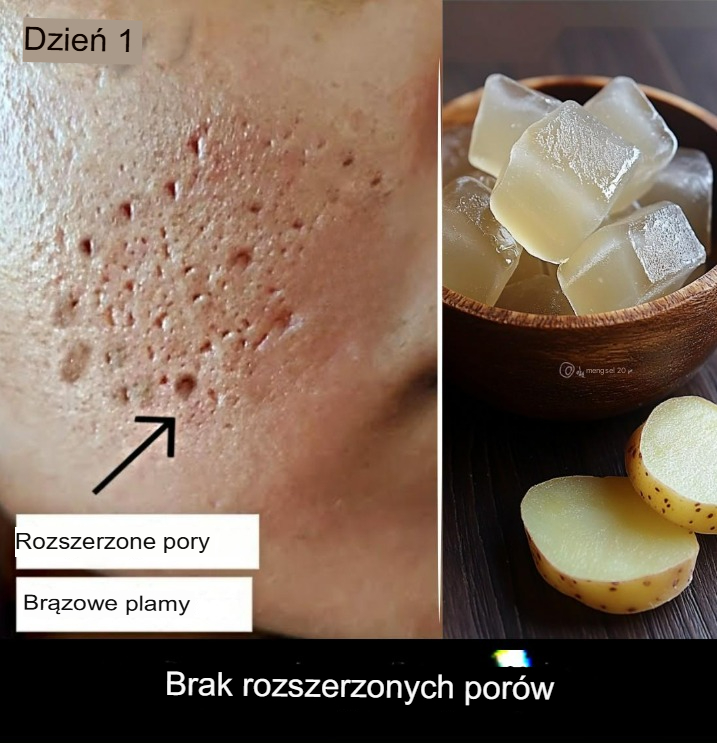 Przemiana skóry w otwarte pory i szkło