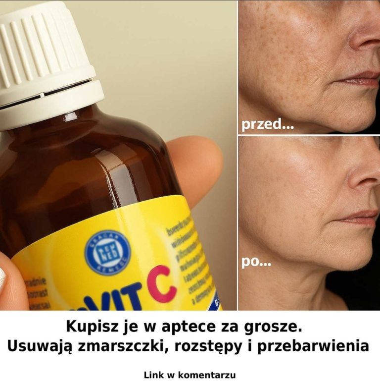 Kupisz je w aptece za grosze. Usuwają zmarszczki, rozstępy i przebarwienia.