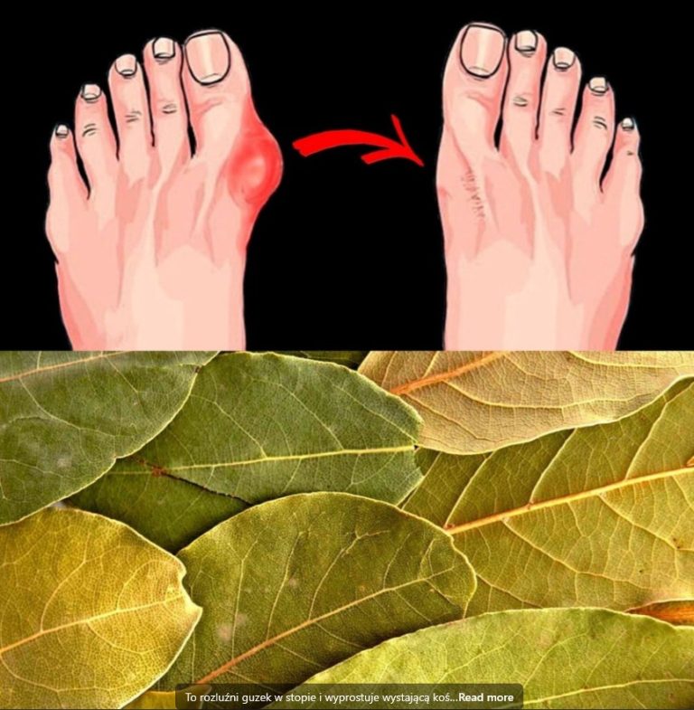 Tytuł: Naturalny sposób na haluksy i zgrubienia stóp – prosty domowy przepis