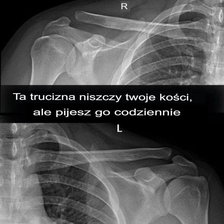 Co się dzieje, gdy pijesz napój gazowany?