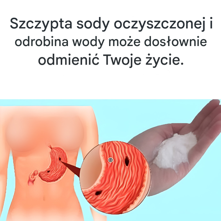 Soda oczyszczona: lepszy naturalny środek na zgagę
